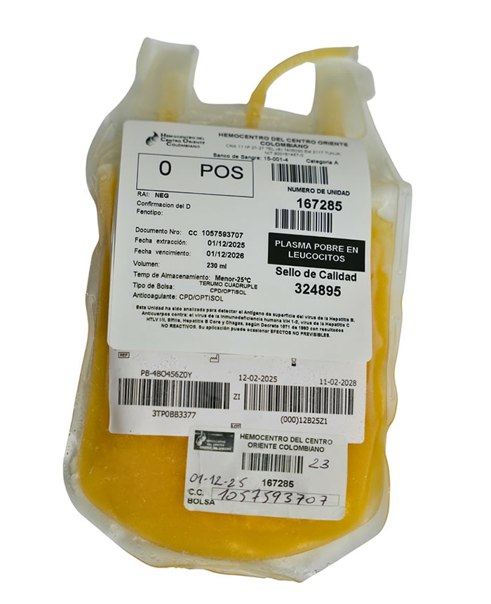 Plasma pobre en leucocitos
